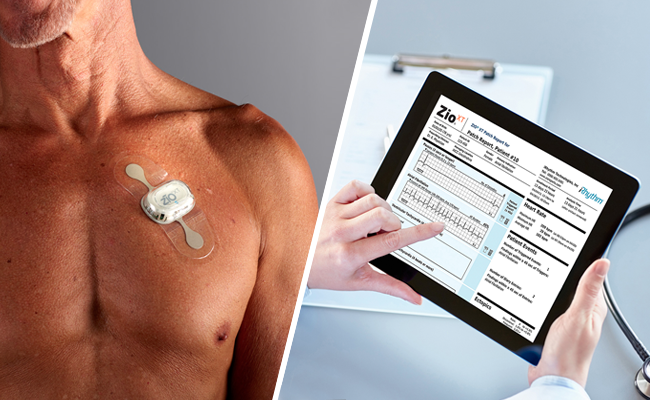 easy-ekg-interpretation-zio-cardiac-monitoring