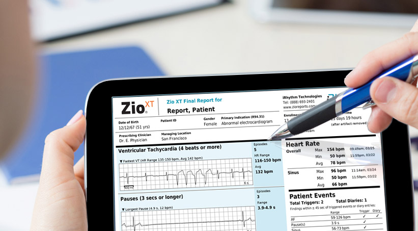 the-zio-by-irhythm-patient-report-comprehensive-intuitive-accurate